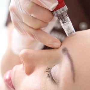 Formation Microneedling Casablanca