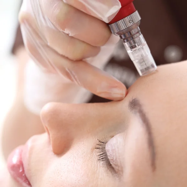 Formation Microneedling Casablanca